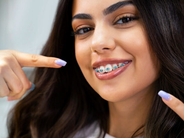 Näkyykö oikomiskoje? Oikomishoidon erikois&shy;hammas&shy;lääkäri antaa luvan hymyillä – ja suudella