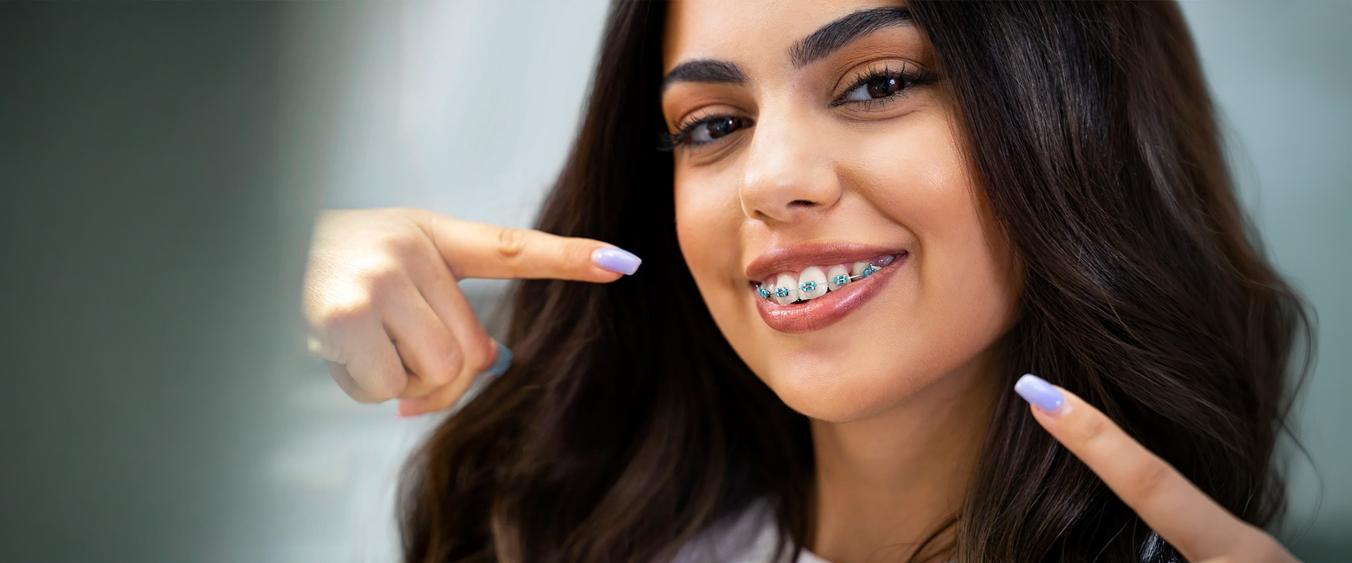 Muodikkaat hammasraudat värikkäillä keraamisilla kiinnikkeillä, oikomishoito Helsingissä ja Vantaalla