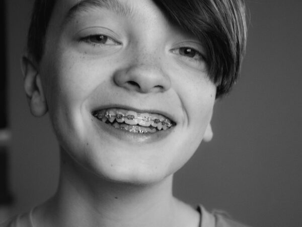 Oikominen ei ole vain esteettistä hymyn kohennusta